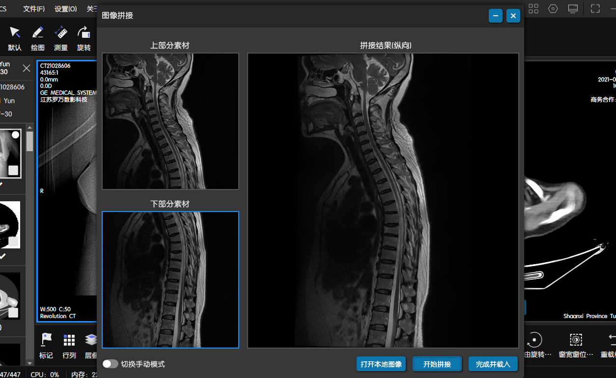 C#处理医学影像(四):基于Stitcher算法拼接人体全景脊柱骨骼影像